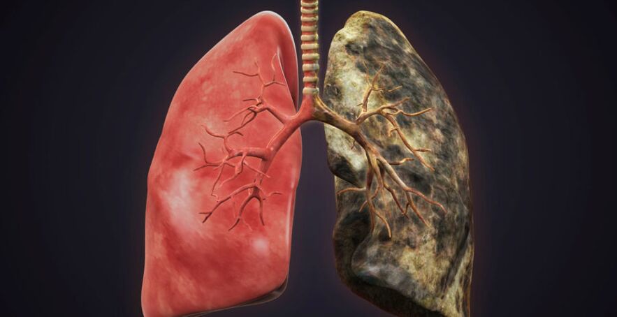 the smoker's lungs and quit smoking the lungs
